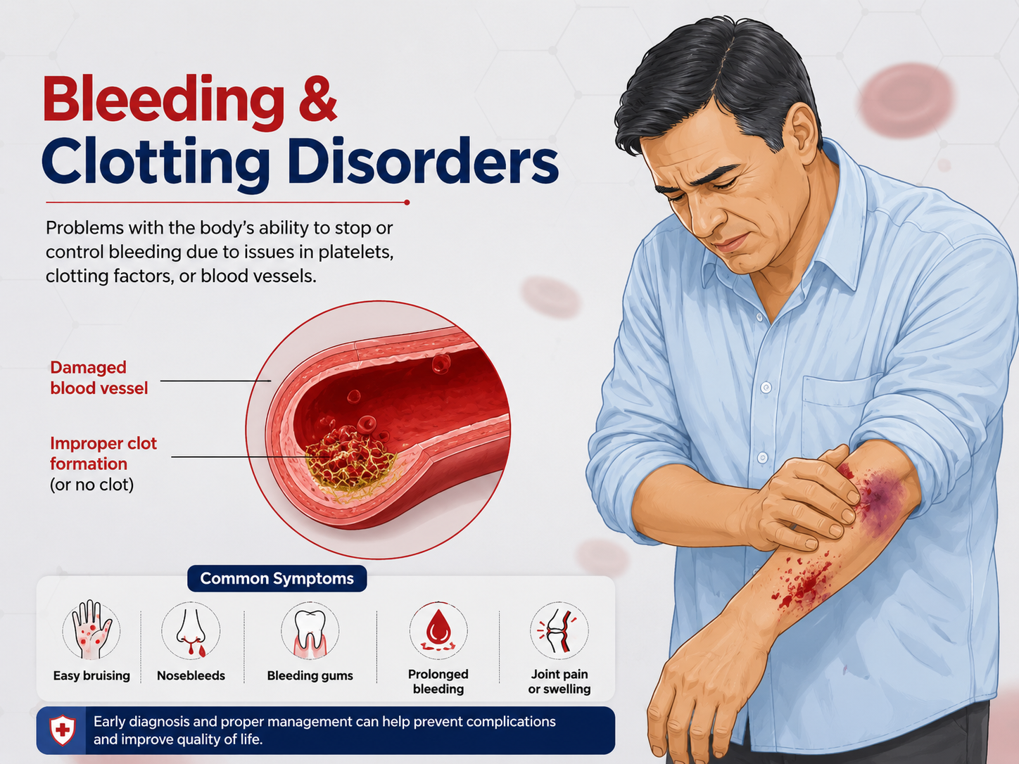 Infographic on bleeding and clotting disorders, showing a damaged blood vessel and common symptoms such as easy bruising, nosebleeds, bleeding gums, prolonged bleeding and joint swelling
